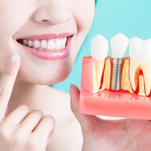 Dentist pointing to her smile and holding model dental implants in Brecksville 
