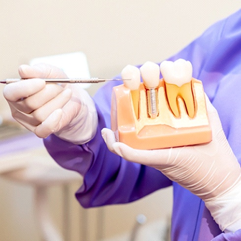 Implant dentist in Brecksville holding model of dental implant