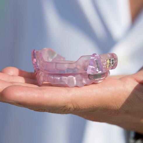 Hand holding an occlusal splint used to treat T M J dysfunction